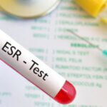 בדיקת ESR (שקיעת דם)